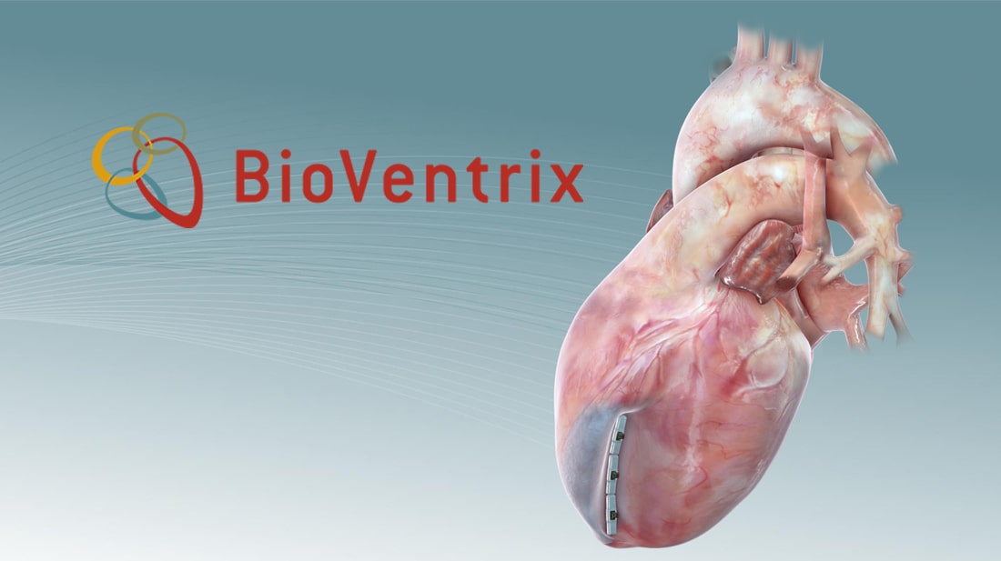 bioventrix